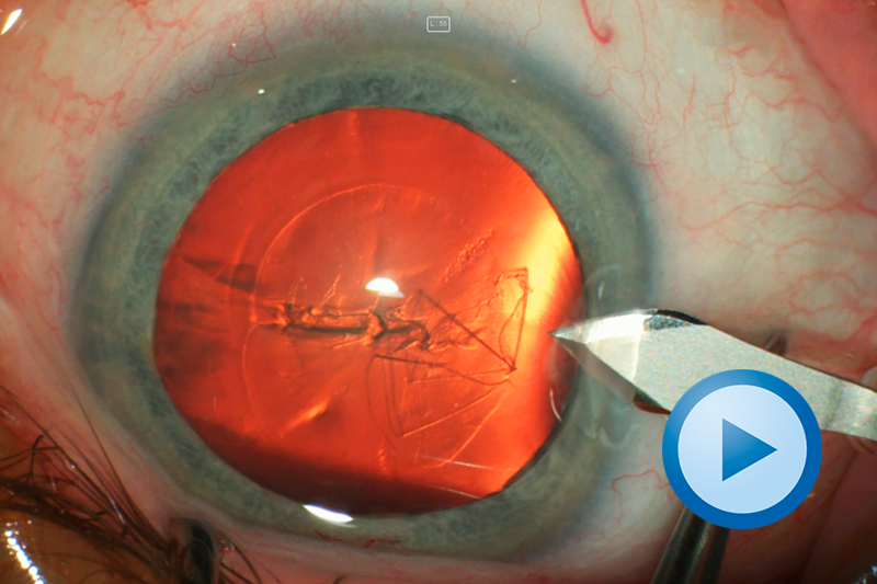 HS_VIDEO-PLAY-BUTTON_Red-Reflex_800x533px